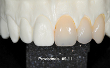 provisionals